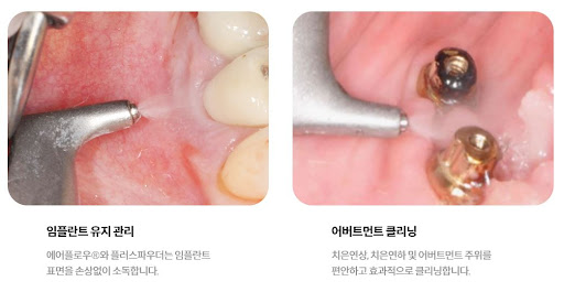 불당본점 서울비디치과의원, 연중무휴 365일 천안시 치아교정 진료 가능